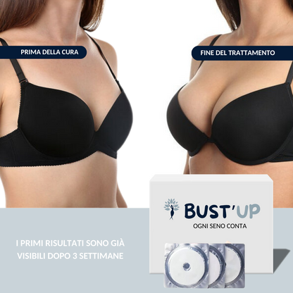BUST'UP – CEROTTO PER L'INGRANDIMENTO DEL SENO